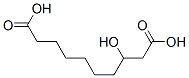 3-hydroxydecanedioic acid 结构式
